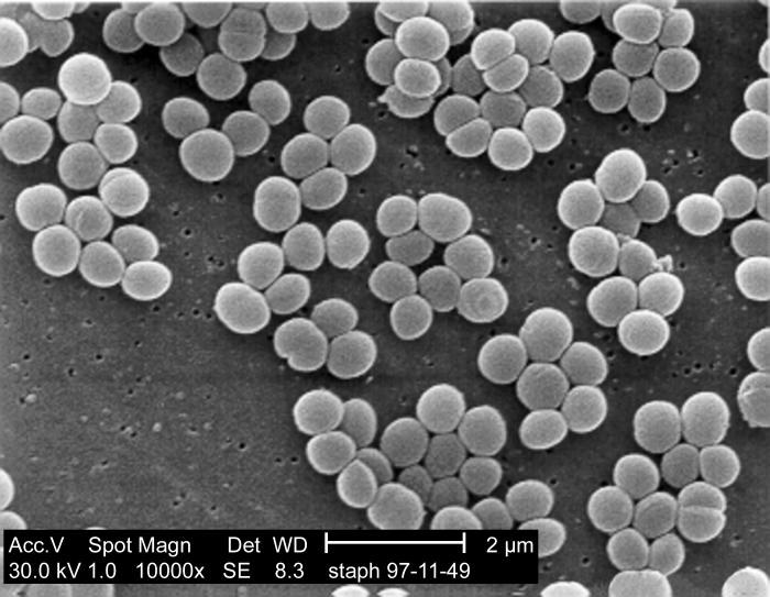 Staphylococcus aureus bakterisinin mikroskop görüntüsü