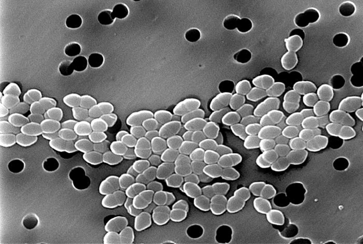 Taramalı elektron mikroskobunda kümeler halinde yuvarlak Enterococcus bakterileri