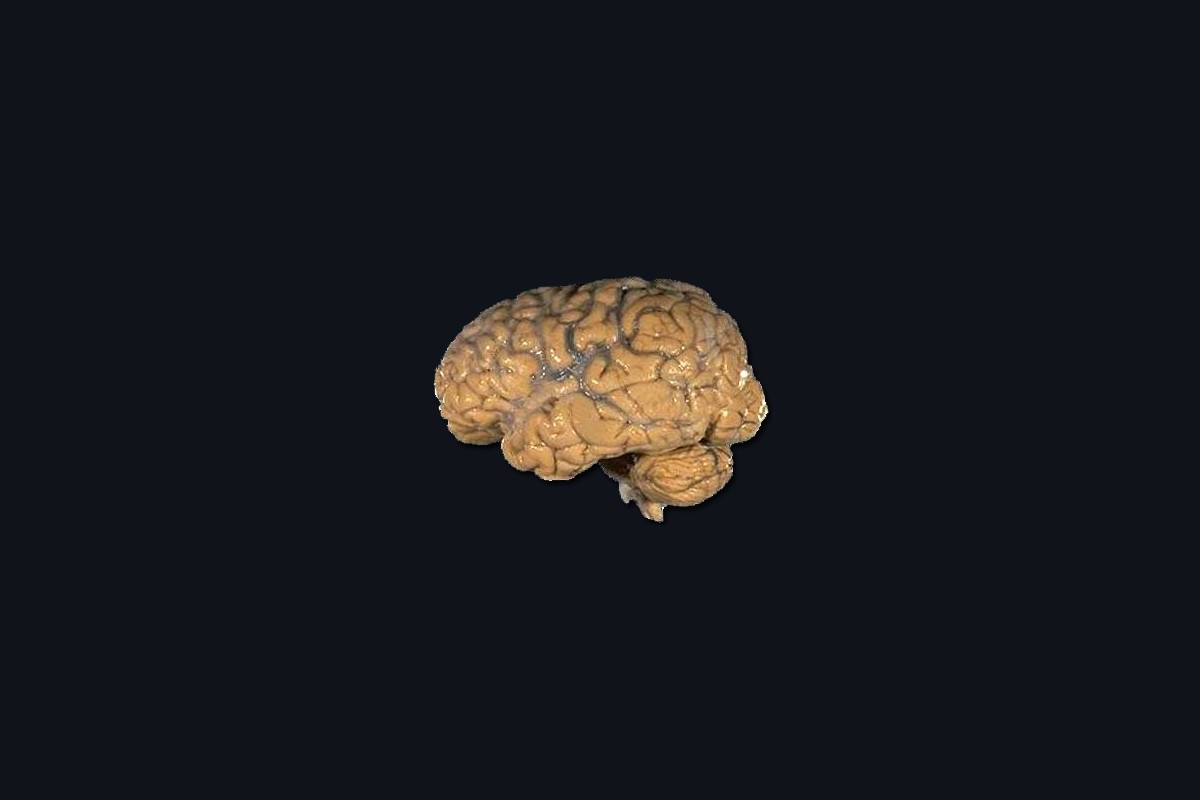 İnsan beyninin yan görünümü, anatomik çizim