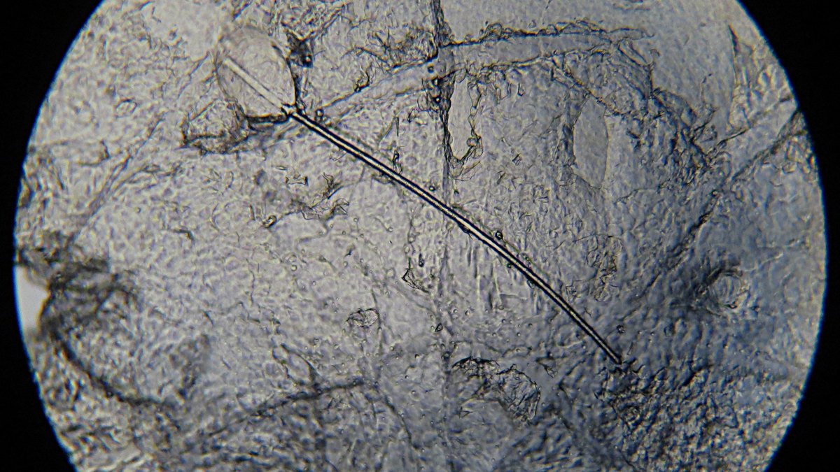 İnsan derisinin epidermis ve dermis katmanları şeması