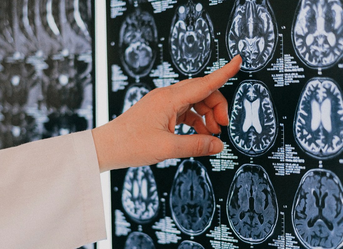 Laboratuvarda kan alma tüpleri