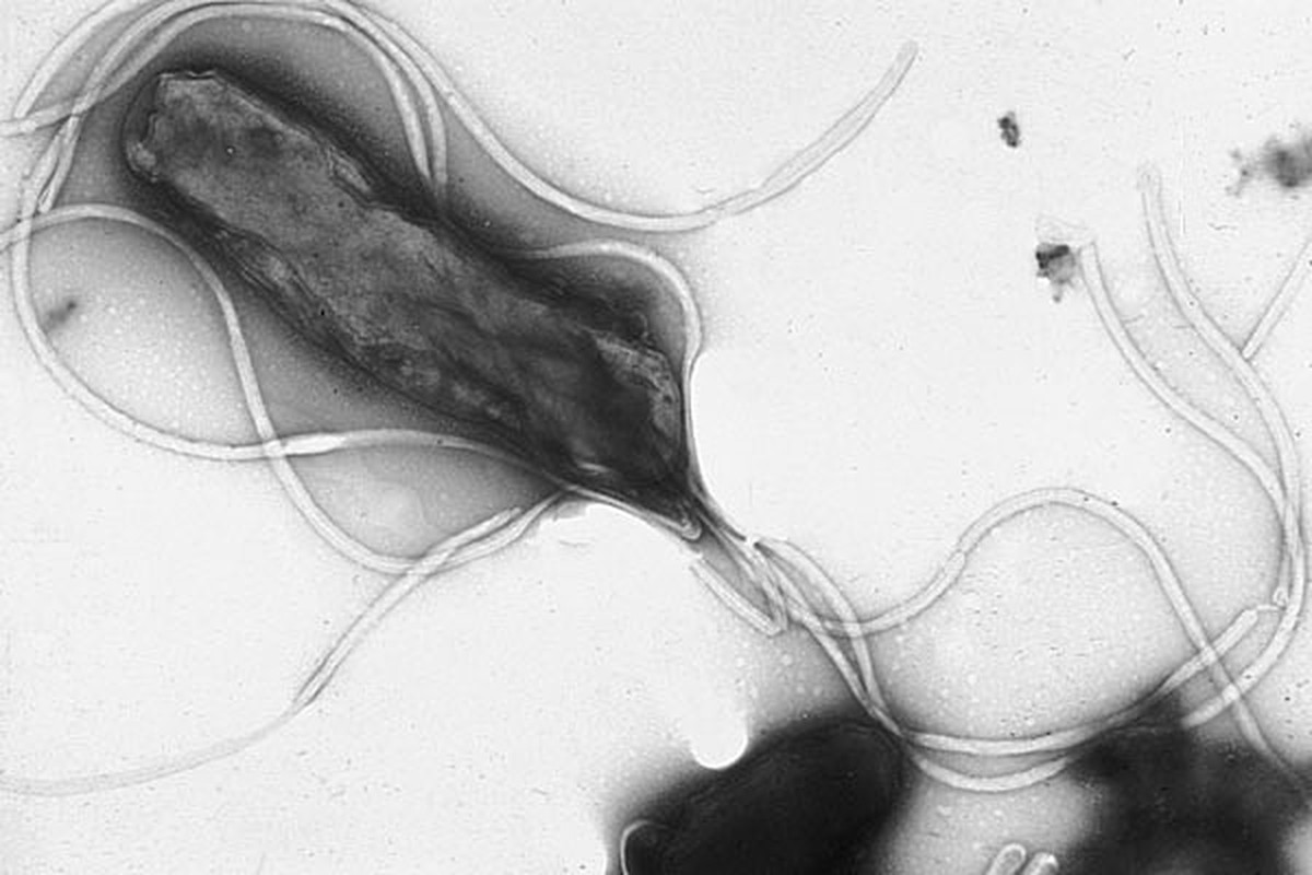 Helicobacter pylori bakterisinin elektron mikroskobu görüntüsü, çok sayıda kamçıyla